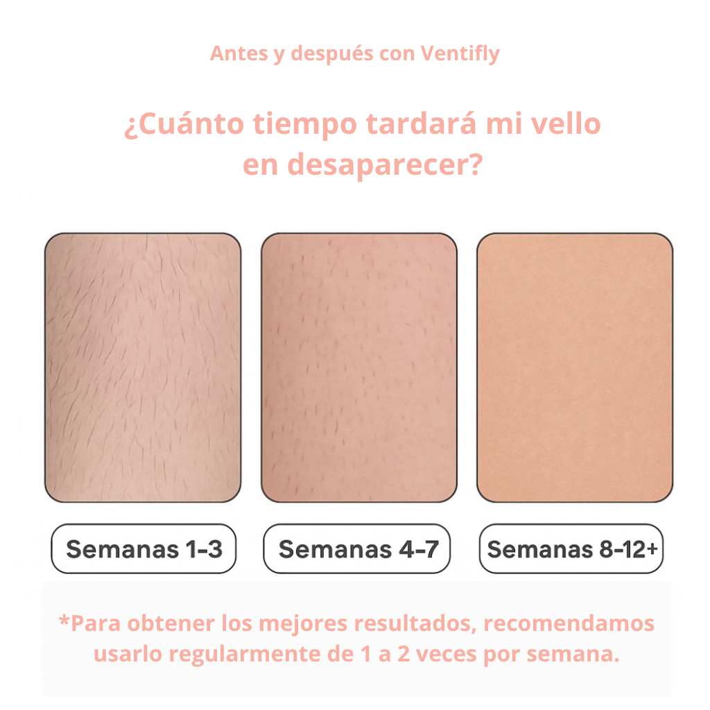 DEPILADORA LÁSER - VENTIFLY