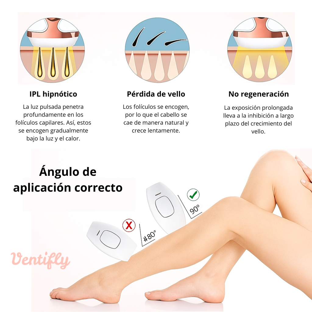 DEPILADORA LÁSER - VENTIFLY