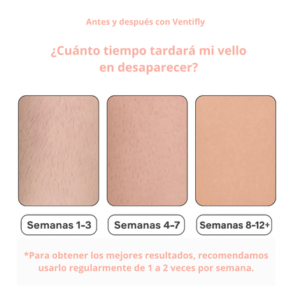 DEPILADORA LÁSER - VENTIFLY